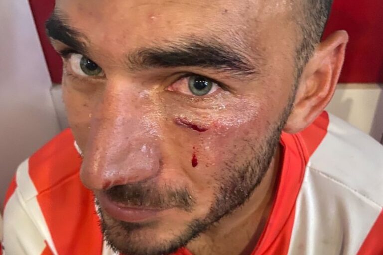 Así terminó Rodrigo Martín por el golpe sufrido de un rival: «es una lástima que haya terminado así», expresó el jugador de Costa